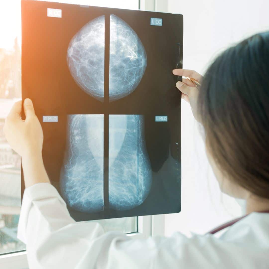 What Happens If My Mammogram Is Abnormal? - PURE Mammography